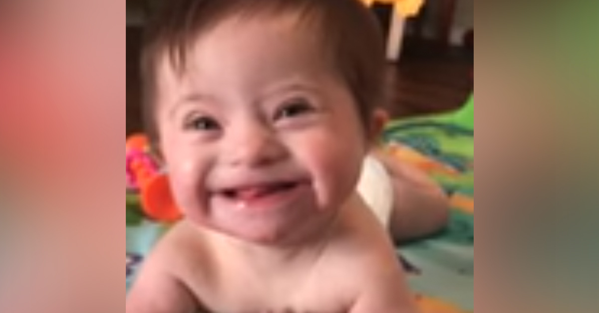 a smiling baby with down syndrome