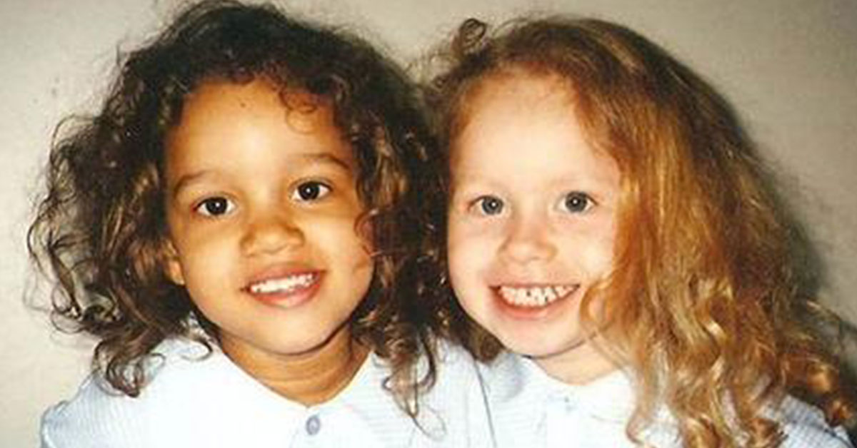 Twin Girls Born with Different Skin Colors Grow Into Beautiful Women